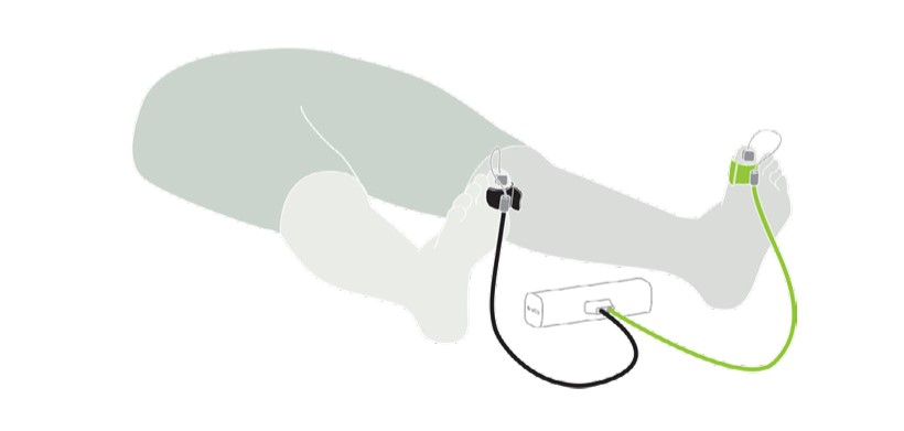 MESI mTABLET TBI - TOE PLACEMENT – PLACING THE CUFF ON THE TOE