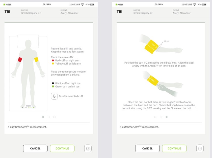 MESI mTABLET TBI - PERFORMING THE TBI MEASUREMENT - Step 5