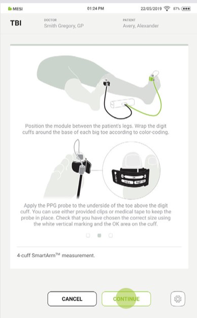 MESI mTABLET TBI - PERFORMING THE TBI MEASUREMENT - Step 6