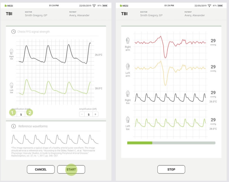 MESI mTABLET TBI - PERFORMING THE TBI MEASUREMENT - Step 7