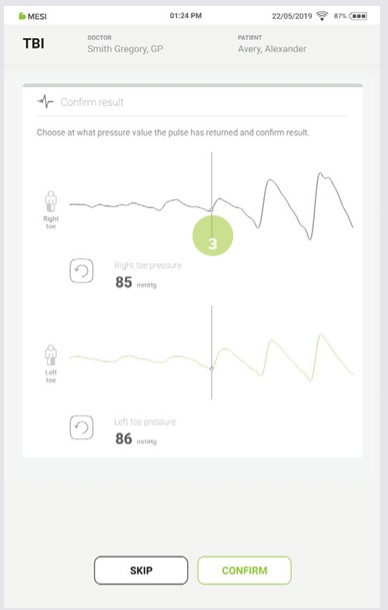 MESI mTABLET TBI - PERFORMING THE TBI MEASUREMENT - Step 9