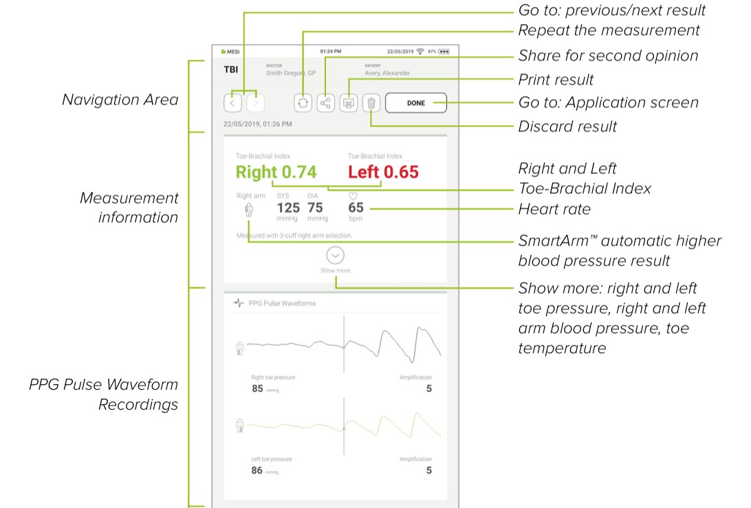 MESI mTABLET TBI - Reviewing a tbi measurement (1)