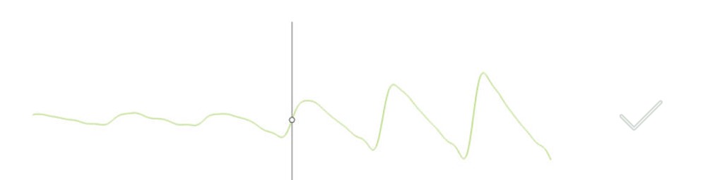 MESI mTABLET TBI -PPG PULSE WAVEFORMS INTERPRETATION AND TOE BLOOD PRESSURE (1)