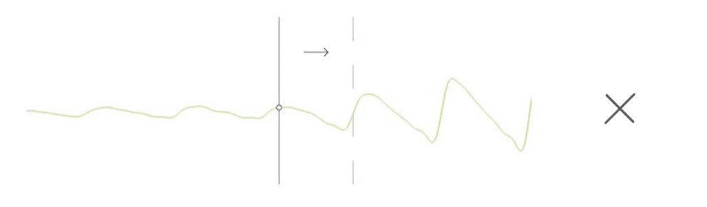 MESI mTABLET TBI -PPG PULSE WAVEFORMS INTERPRETATION AND TOE BLOOD PRESSURE (2)