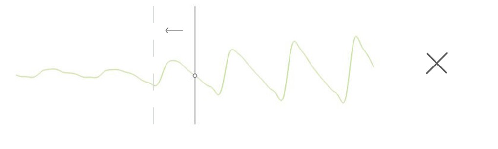MESI mTABLET TBI -PPG PULSE WAVEFORMS INTERPRETATION AND TOE BLOOD PRESSURE (3)