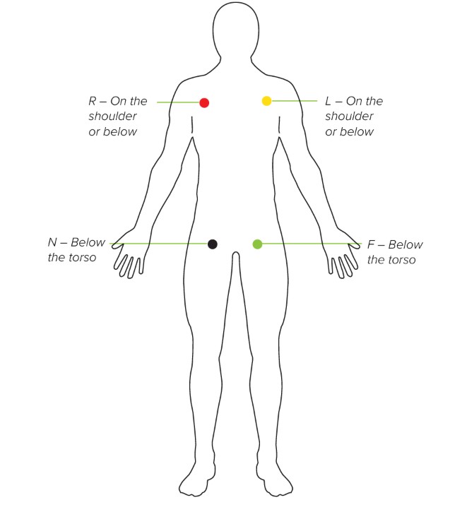 MESI mTABLET ECG - Electrode placement