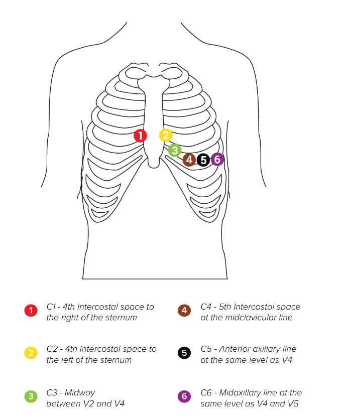 MESI mTABLET ECG - Electrode placement (2)