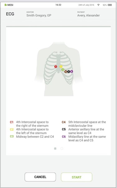 MESI mTABLET ECG - Recording the ecg - Step 3
