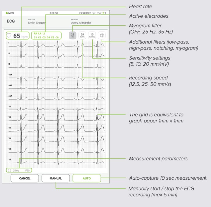 MESI mTABLET ECG - Recording the ecg - Step 7