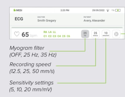 MESI mTABLET ECG - Recording the ecg - Step 8