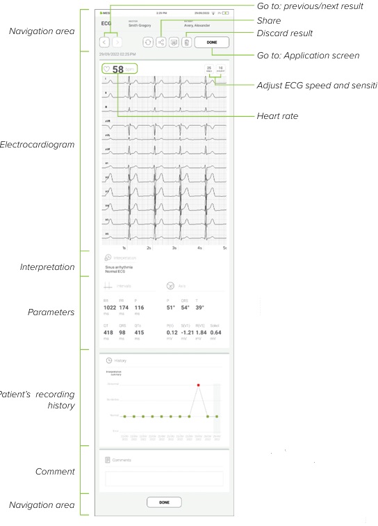 MESI mTABLET ECG - Reviewing ECG