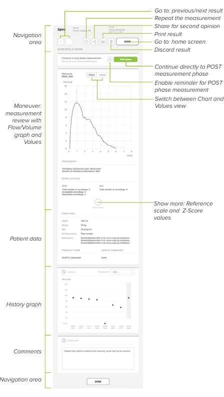 MESI mTABLET SPIRO - Reviewing a spiro measurement