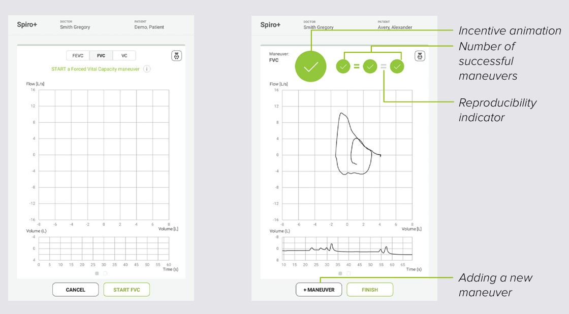 MESI mTABLET SPIRO - SPIRO+ FVC Maneuver