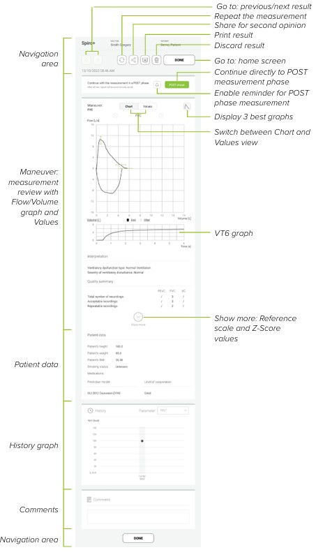 MESI mTABLET SPIRO - REVIEWING SPIRO+ MEASUREMENT