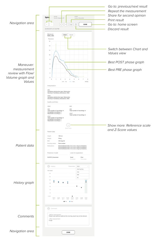 MESI mTABLET SPIRO - Reviewing the result in post measurement phase