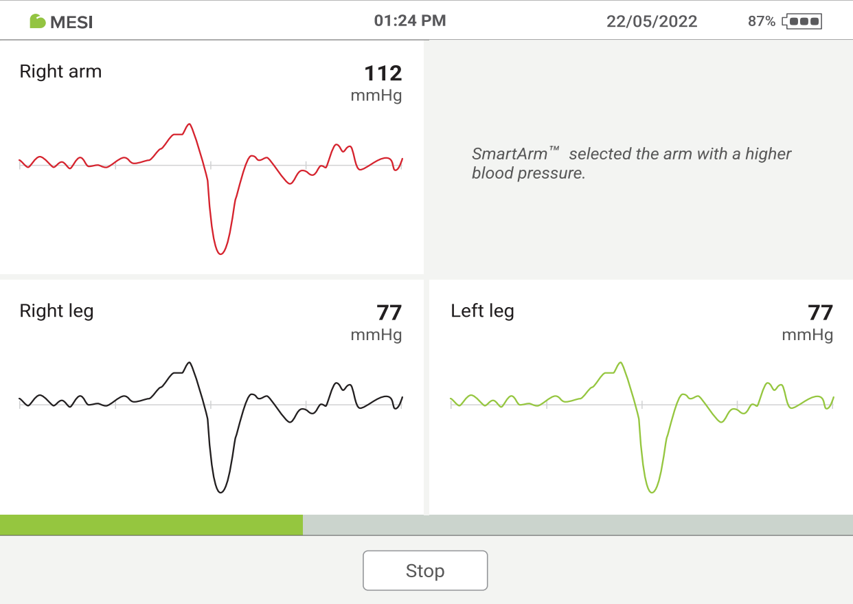 MESI ABPI MD measurement