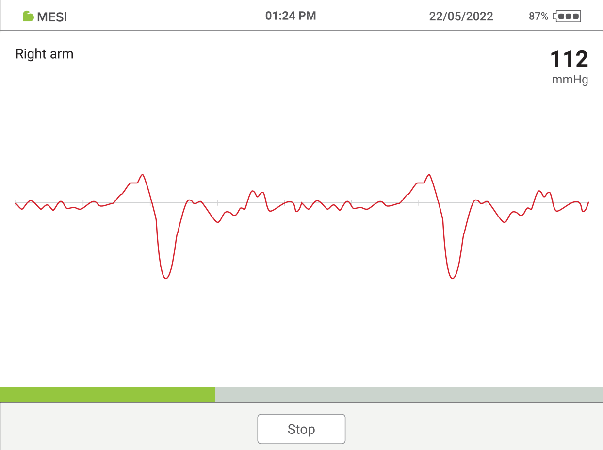 MESI ABPI MD BP measurement