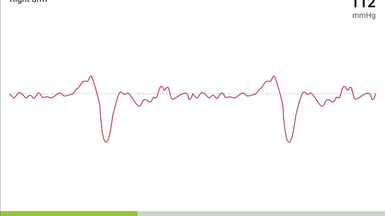 MESI ABPI MD BP measurement
