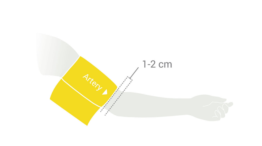 ABPI MD cuff placement