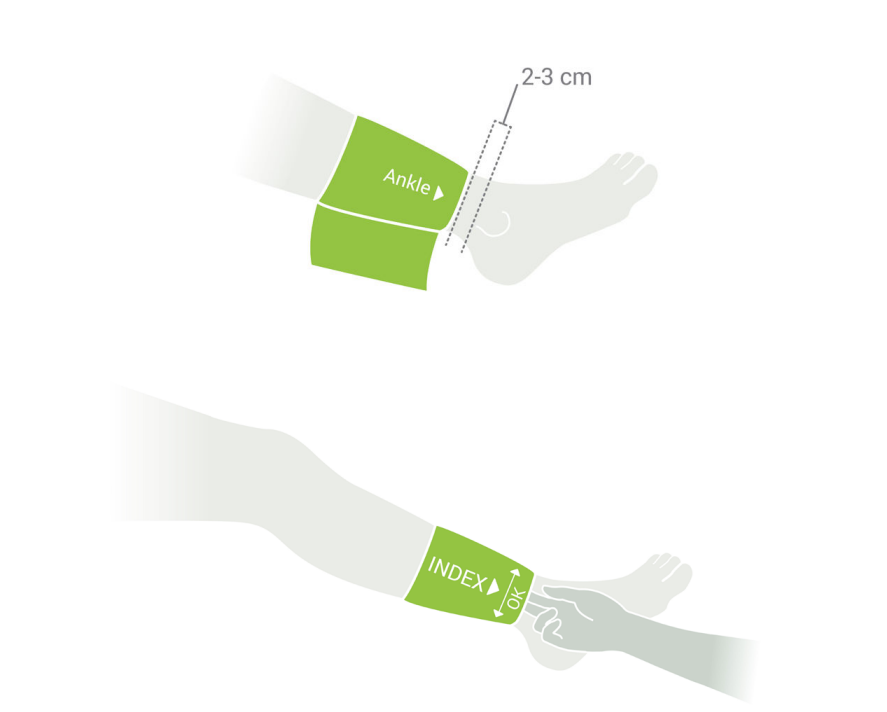 ABPI MD ankle cuff placement