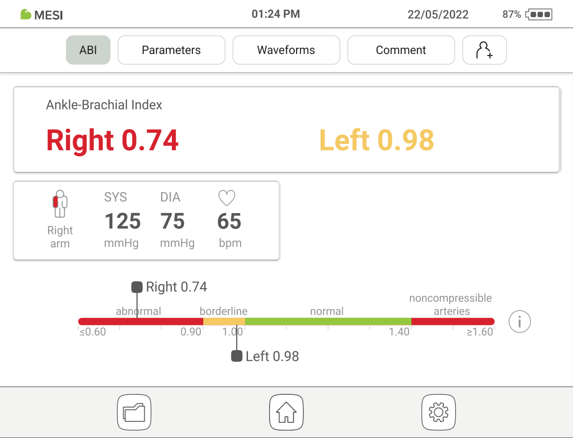 MESI ABPI MD Ankle-Brachial measurement results