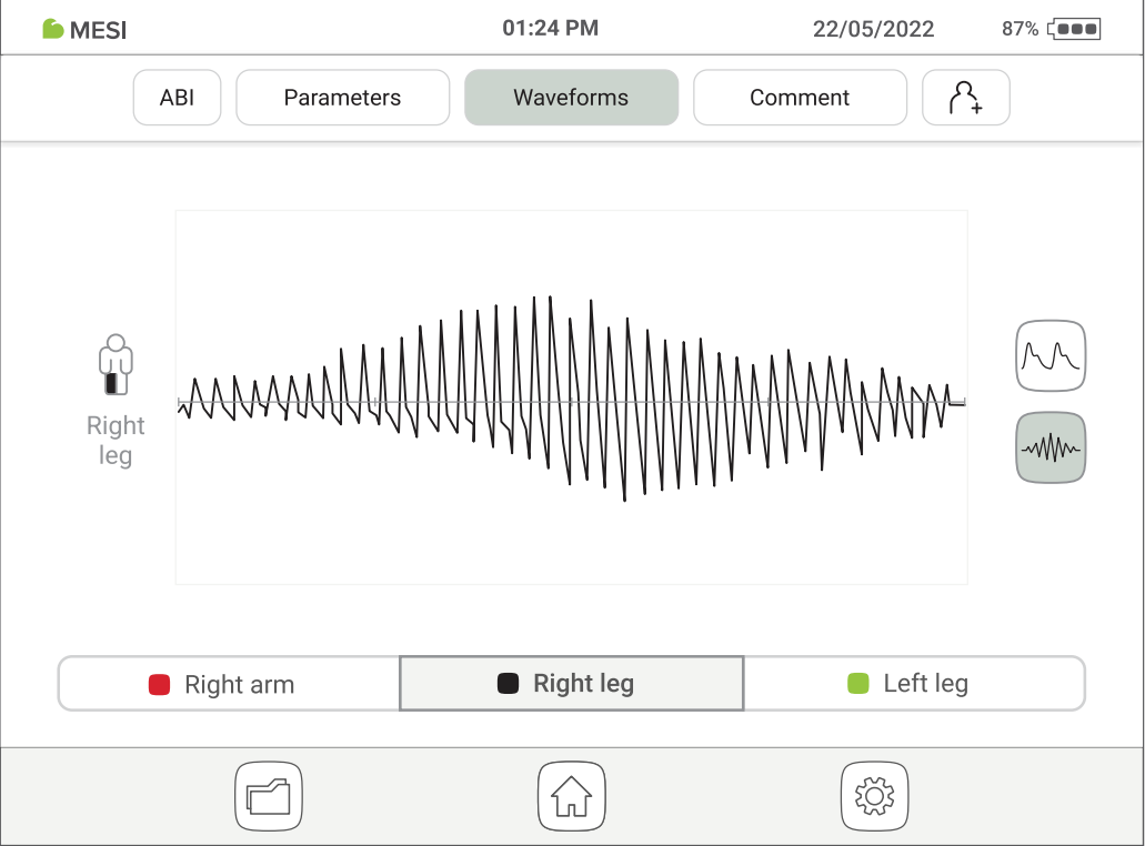 MESI ABPI MD waveforms