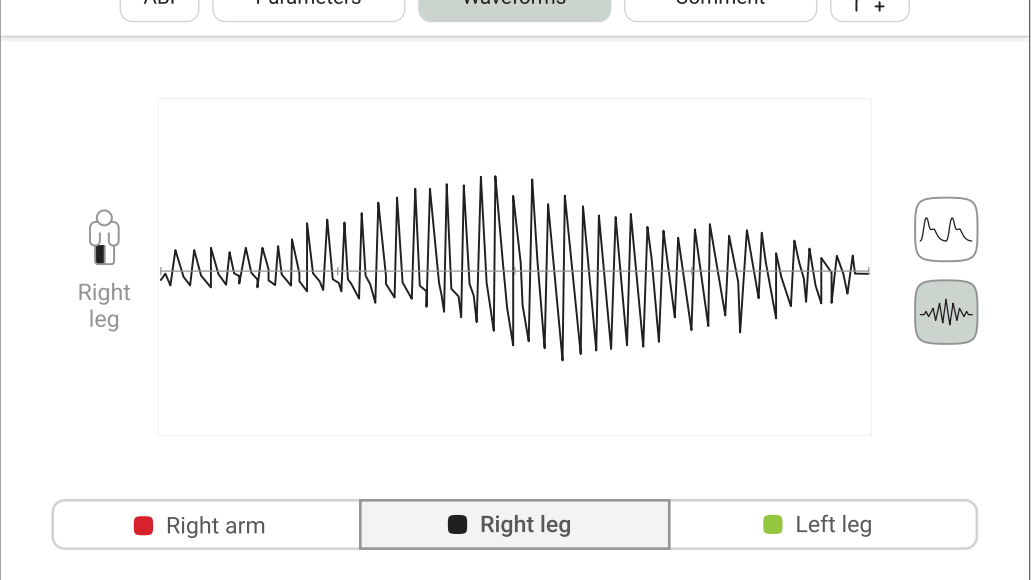 MESI ABPI MD waveforms