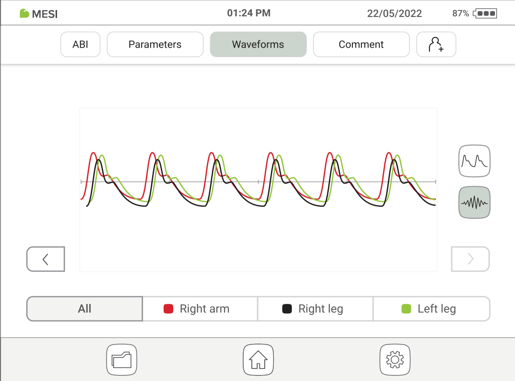 MESI ABPI MD waveforms