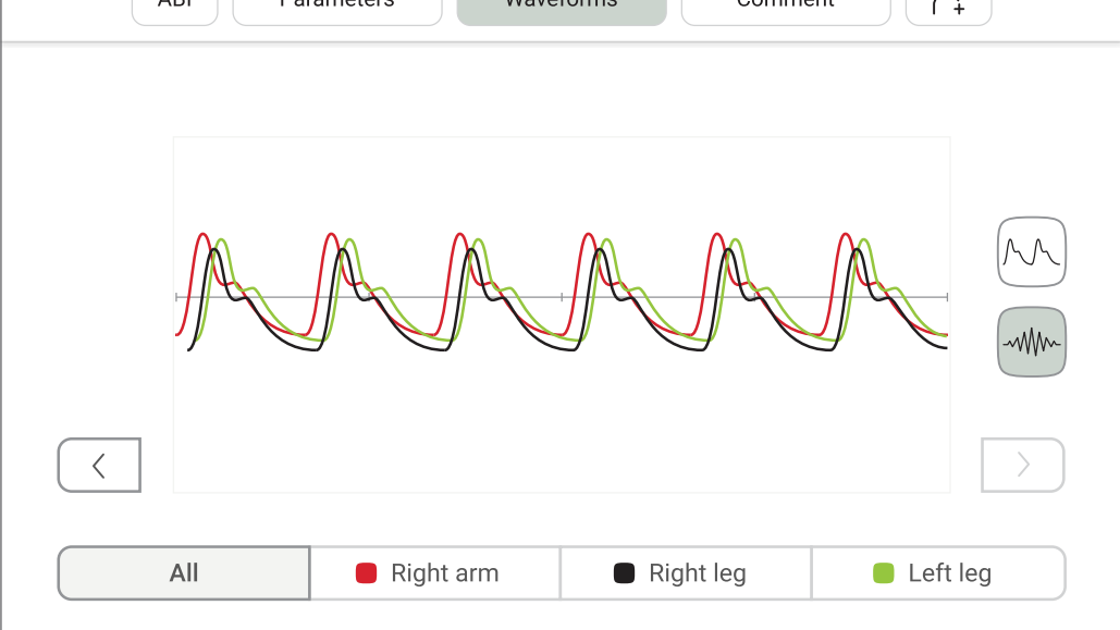 MESI ABPI MD waveforms