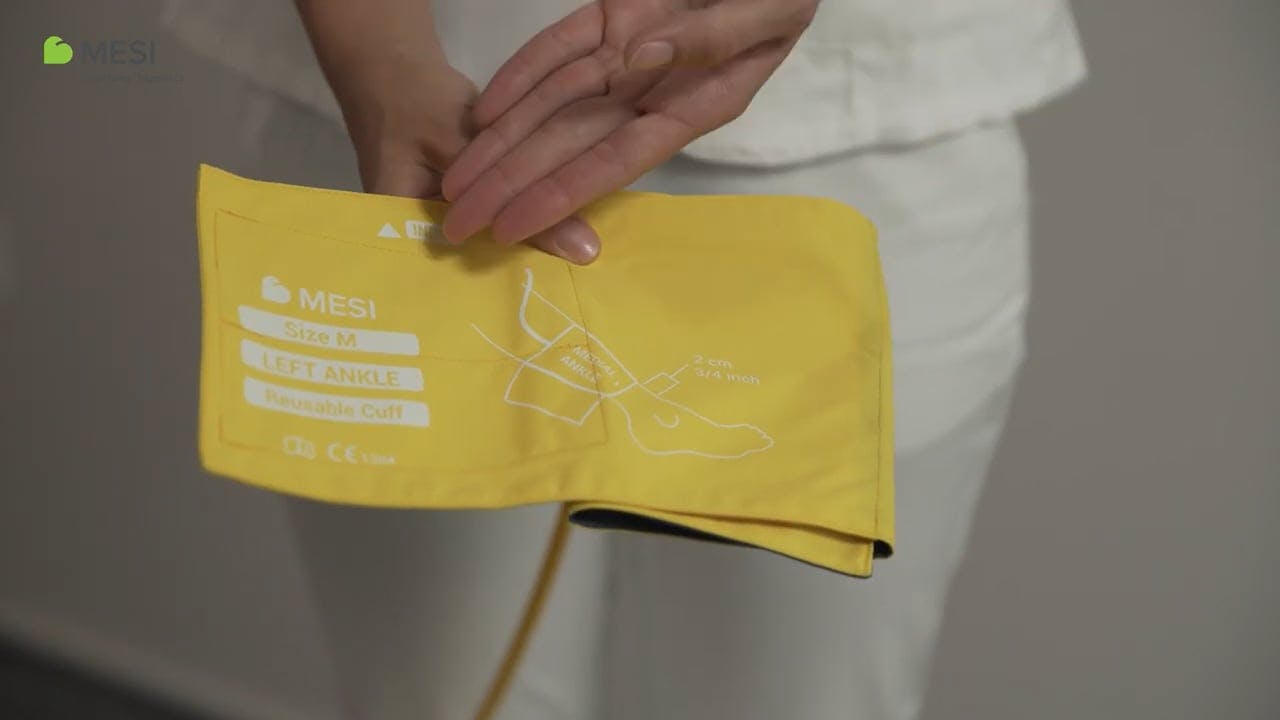 ABI measurement with ABPI