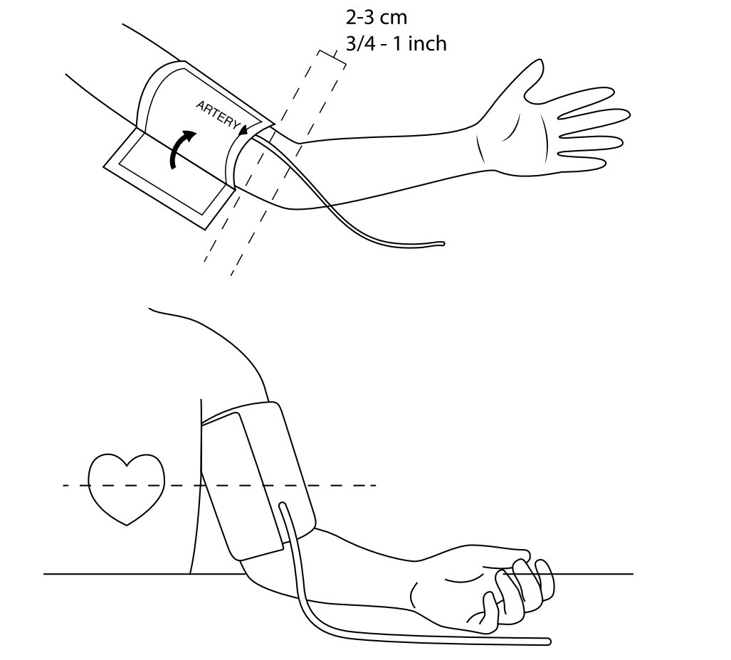 ABPI MD blood pressure measurement