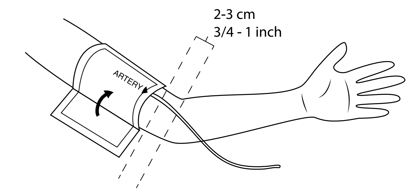 ABPI MD cuff placement