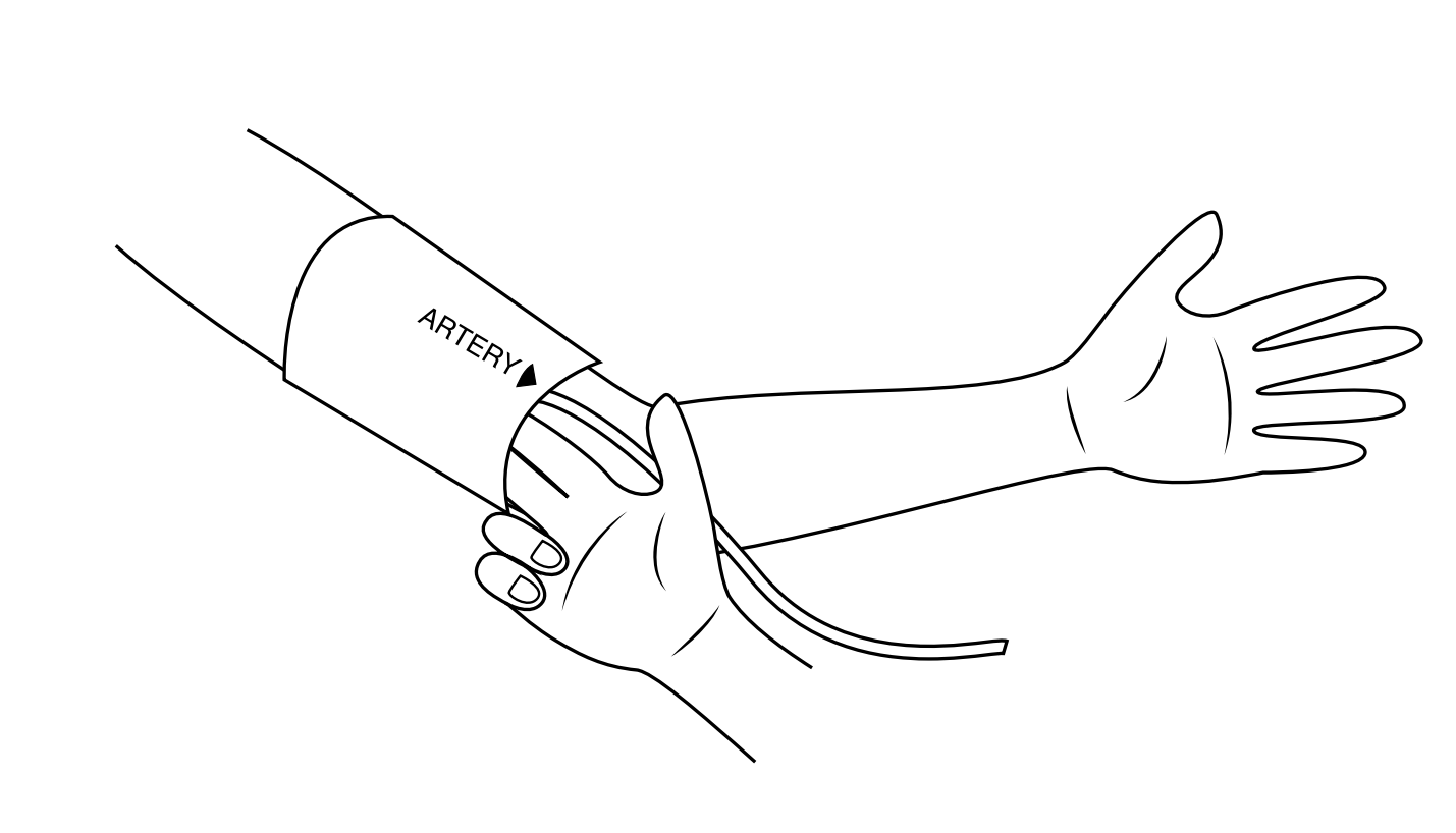 ABPI MD cuff placement