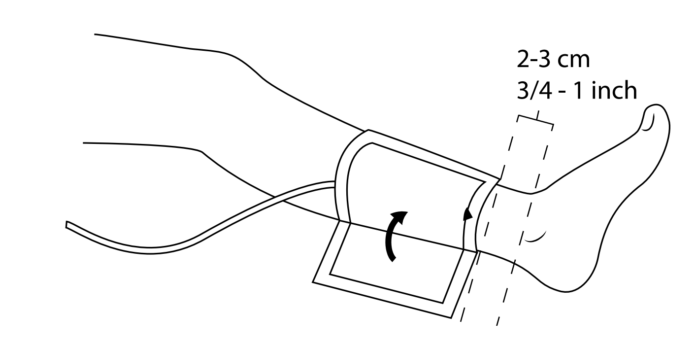 ABPI MD cuff placement