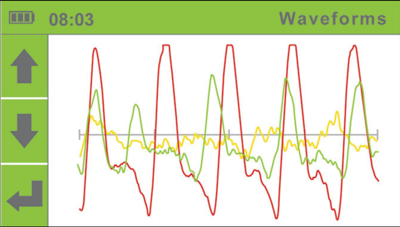 ABPI MD waveforms