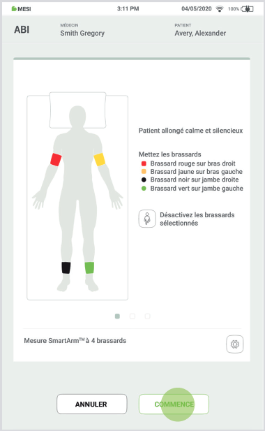 Réaliser une mesure de l’ips-etape 4