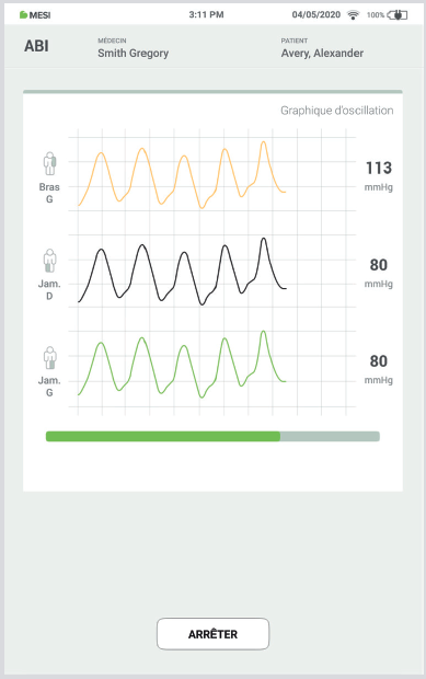 Réaliser une mesure de l’ips-etape 5