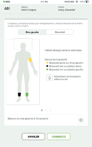 Realiser une mesure de lips-Etape4