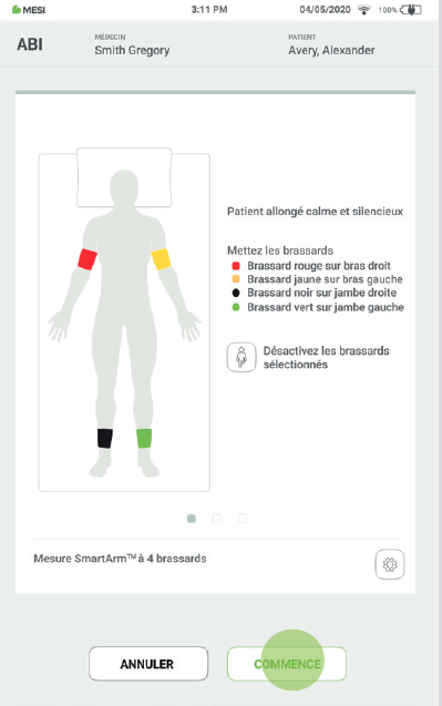 Realiser une mesure de lips-Etape5