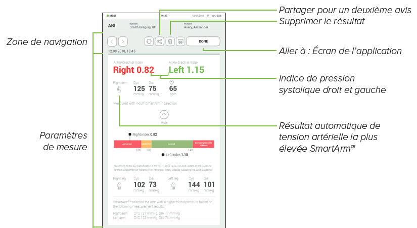 Analyser-la-mesure-de-lips-1