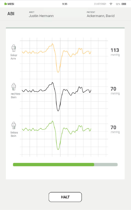 Durchführung von abimessungen-schritt5