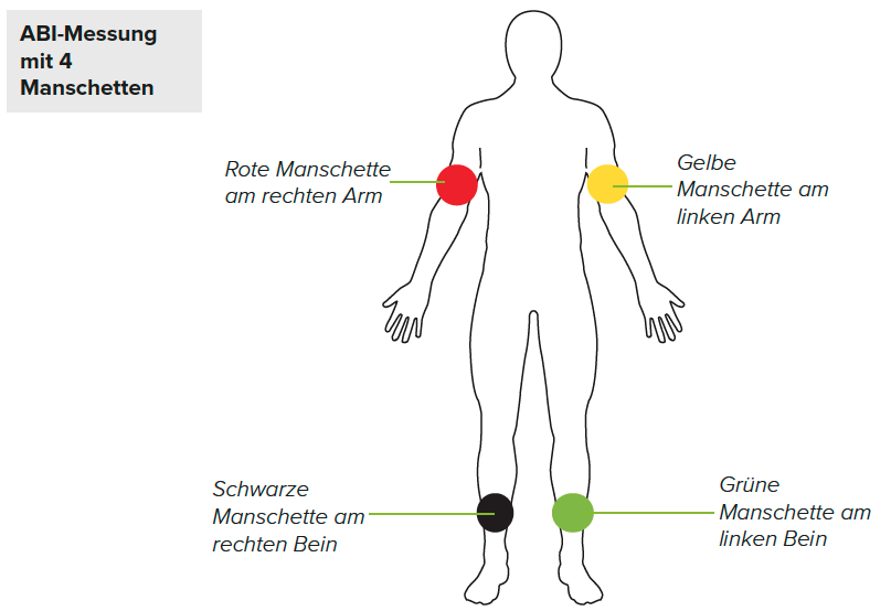 MANSCHETTENPOSITIONIERUNG1