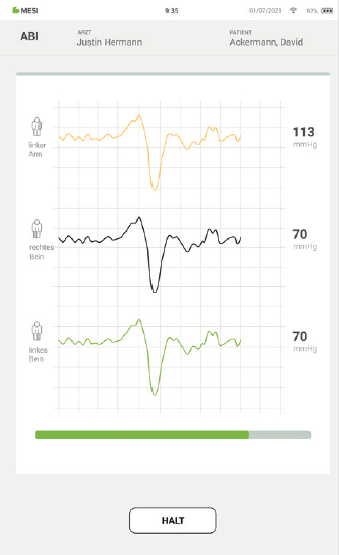DURCHFÜHRUNG DER ABI-MESSUNG-4