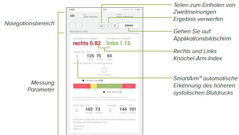 ÜBERPRÜFUNG EINER ABI-MESSUNG-1