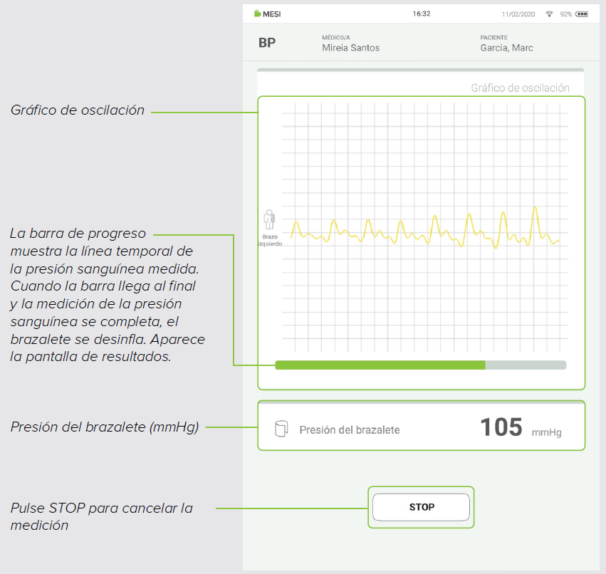 MESI mTABLET BP - PERFORMING THE BP MEASUREMENT - Step 4