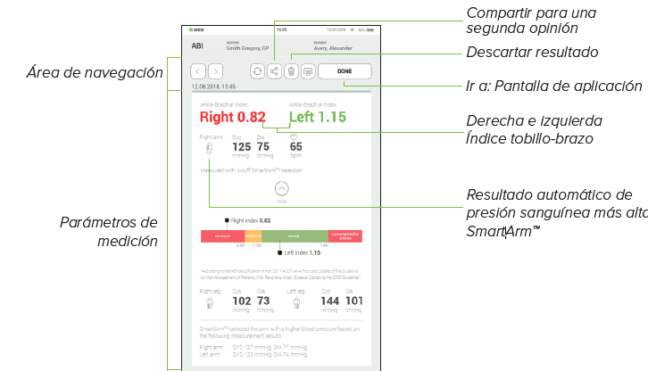 REVISIÓN DE UNA MEDICIÓN DEL ITB-1