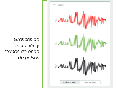 REVISIÓN DE UNA MEDICIÓN DEL ITB-2