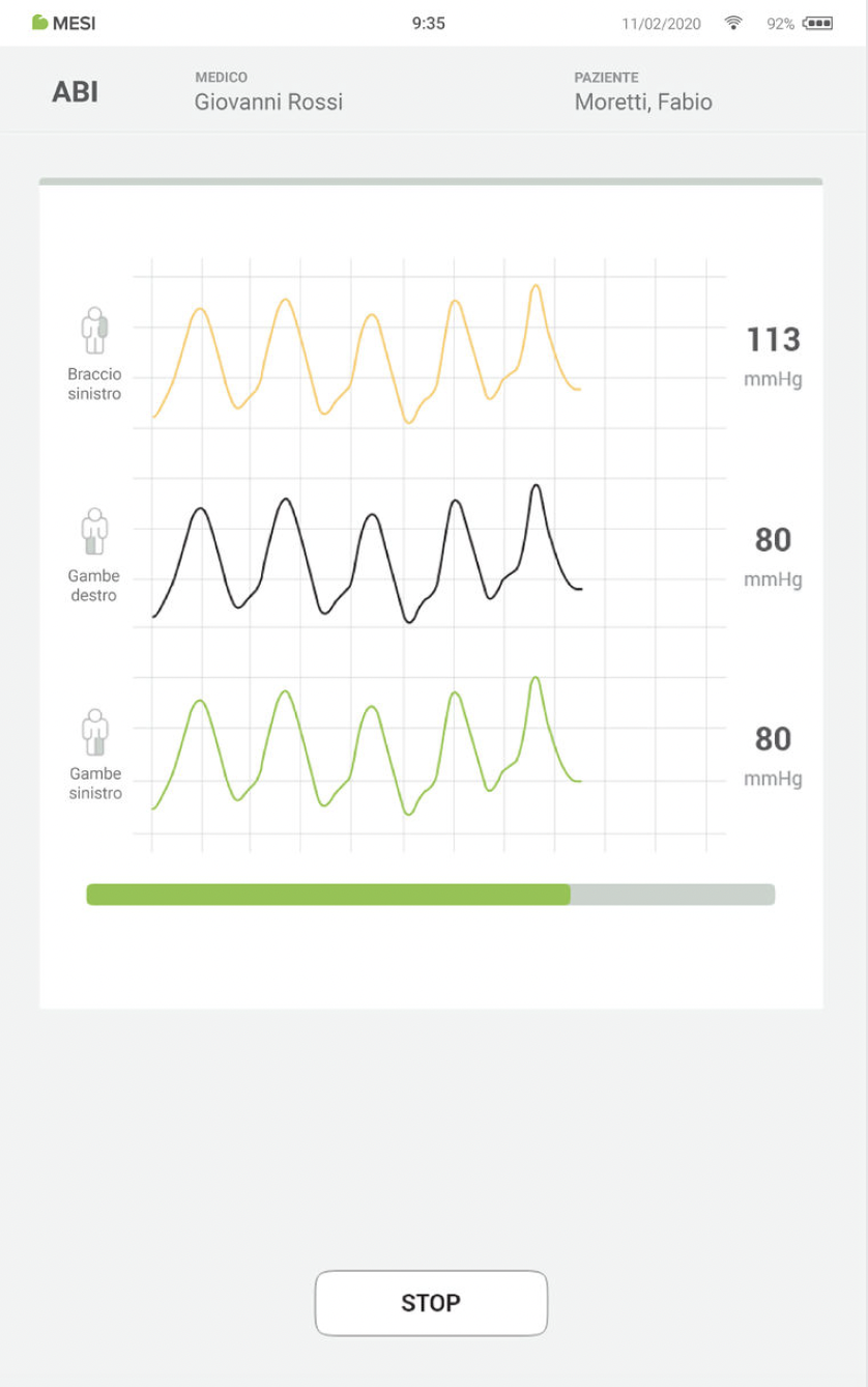 EFFETTUARE UNA MISURAZIONE ABI-5