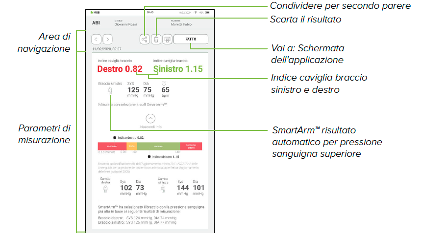 ESAME DI UNA MISURAZIONE ABI-1
