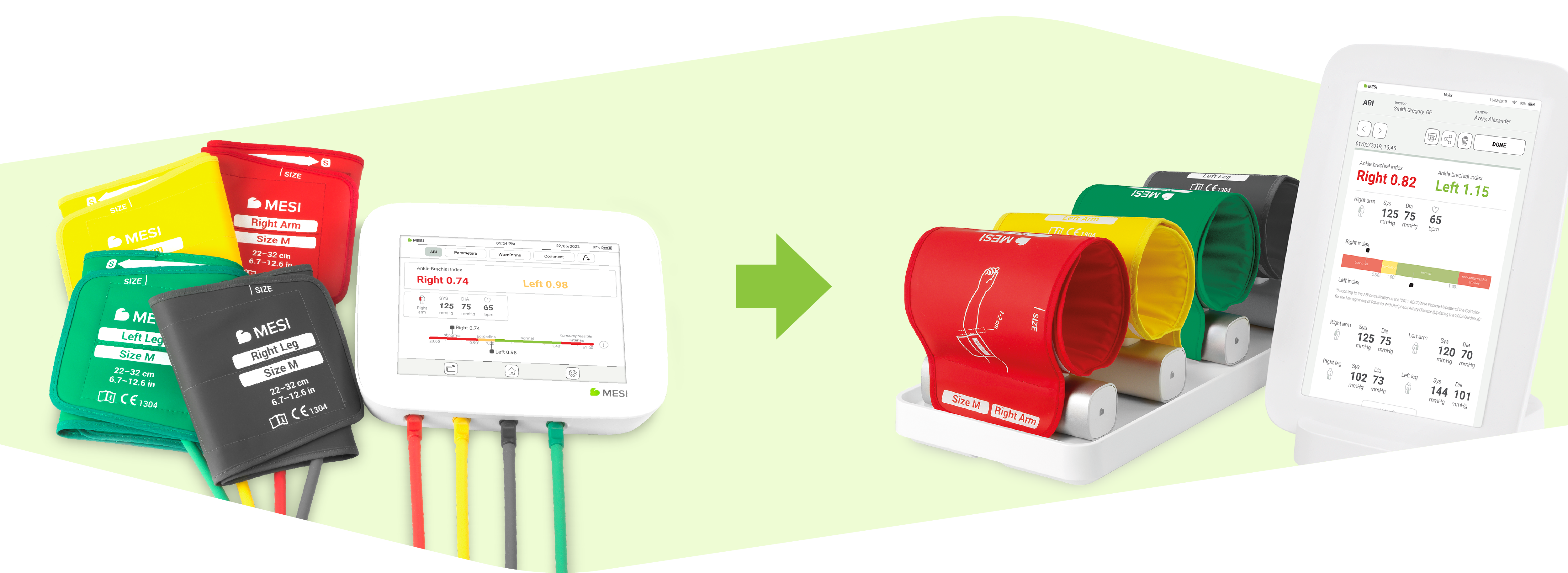 Upgrade your ABPI MD to MESI mTABLET ABI